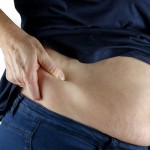 Ilustrasi seseorang dengan lemak di perut. (ANTARA/Pixabay)-1678331575